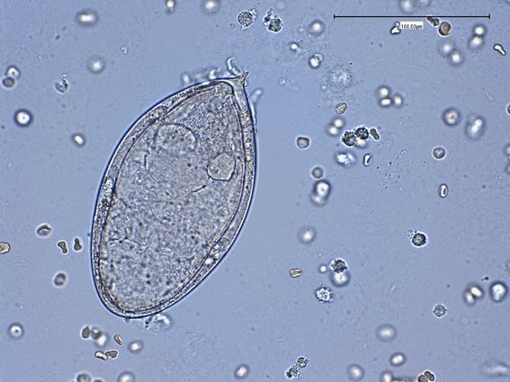 Fun With Microbiology (What's Buggin' You?): Schistosoma mansoni