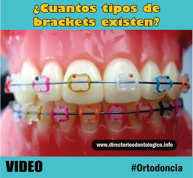 Brackets