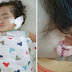 'Mungkin dia panik & rentap anting² dengan kuat' - Telinga bayi 10 bulan terkoyak