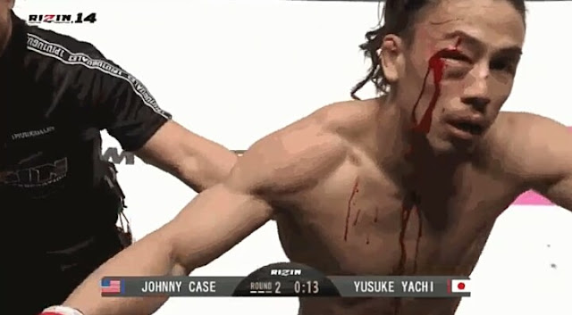 Rizin 14 : Johnny Case def. Yusuke Yachi via TKO (doctor’s stoppage)