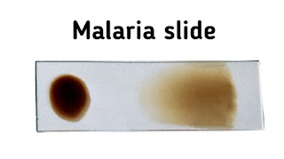 malaria-stain