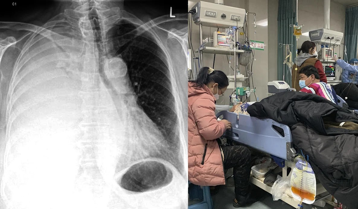 ivan-rodriguez-gelfenstein-health-alert-mysterious-outbreak-of-white-lung-pneumonia-in-children-in-the-us