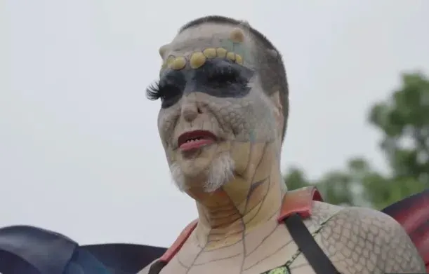 Elite Banker Shapeshifts Into Genderless Reptilian Via Surgery To Deal With ‘Spiritual Pain’ of Being Human