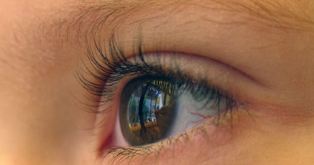 Penyebab Dan Cara  Menghilangkan  Lingkaran Hitam Di Mata  