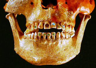 ancient Mayan scull with dental work