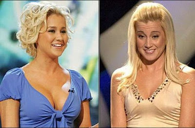 Celebrity Breasts on Celebrities Before And After Breast Implants    China News