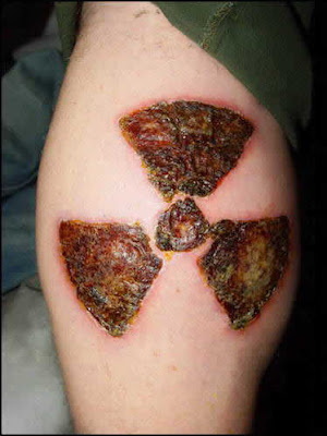 Weird Skin Burning Tattoos | painful Tattoos