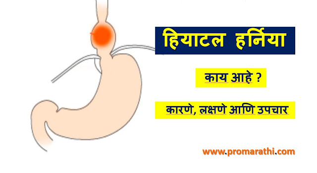 Hiatal Hernia in Marathi