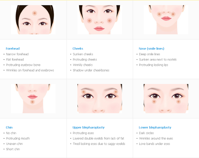 짱이뻐! - Korean Anti-Aging - Fat Grafting