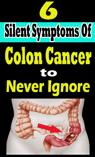 6 Silent Symptoms Of Colon Cancer to Never Ignore