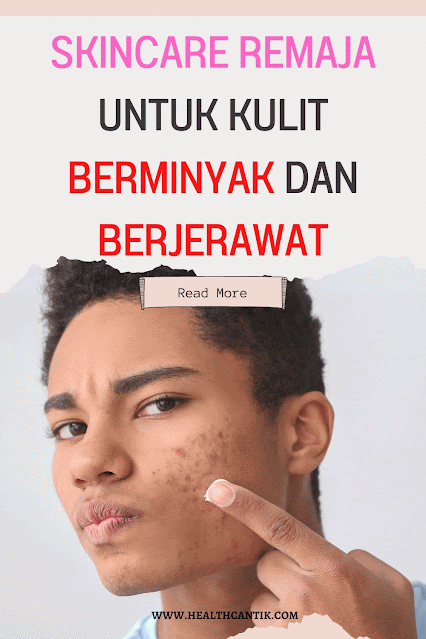 kulit berminyak dan berjerawat pada remaja