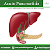 Acute Pancreatitis: Overview, Symptoms, Diagnosis and Treatment