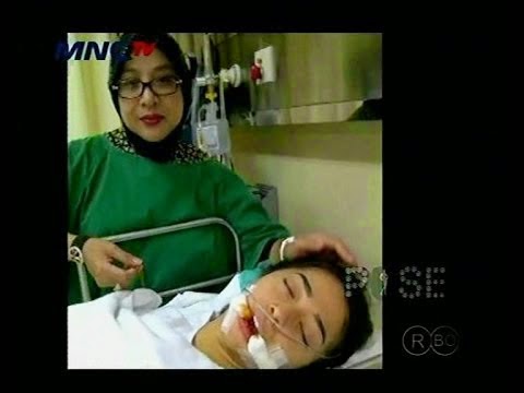 DR OZ Indonesia Tips Tindakan Operasi Gigi Geraham Seperti 