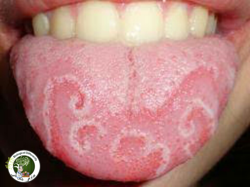 I have painting on my tongue I have painting on my tongue