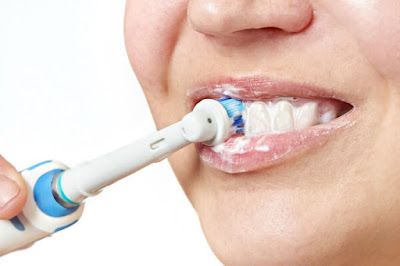 Chăm sóc răng sauu khi trồng thế nào