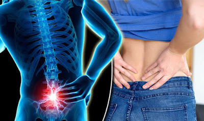 5 Top Secrets for Avoiding Back Pains