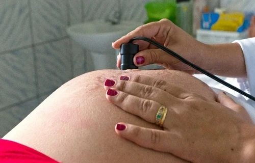 Mortalidade de gestantes é mais que o dobro da média no país