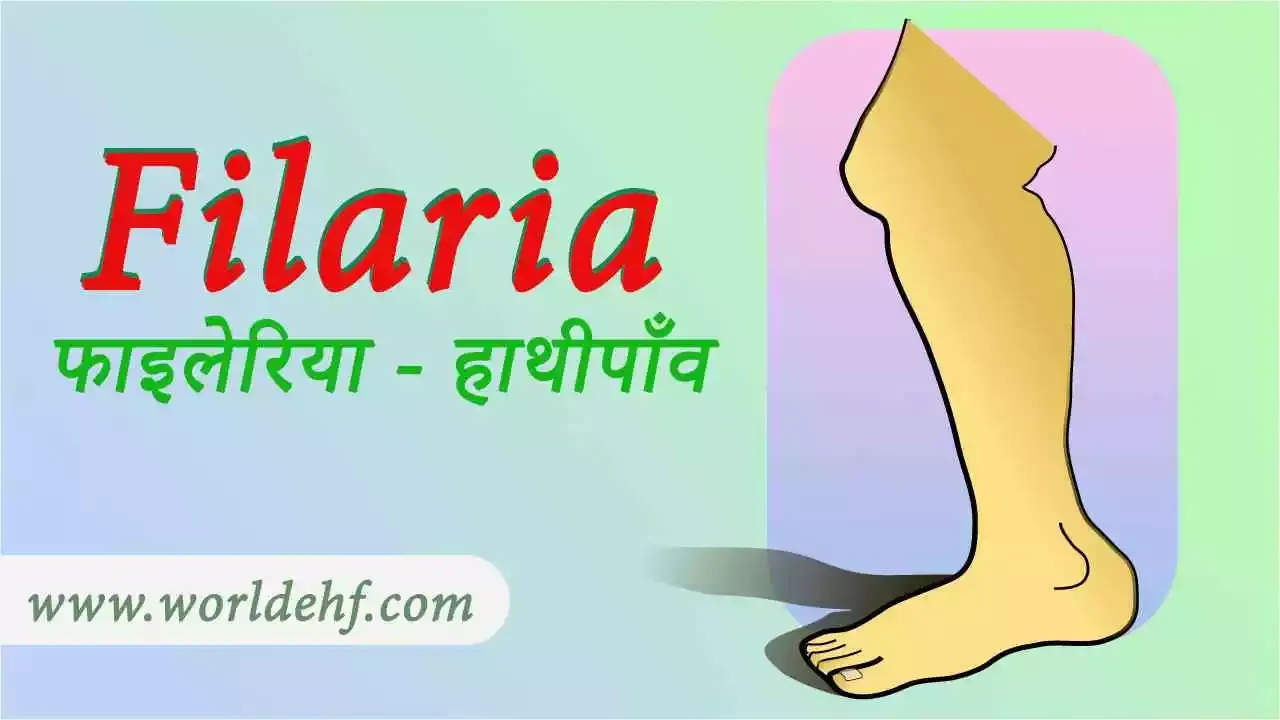 Electro Homeopathic treatment of Filaria