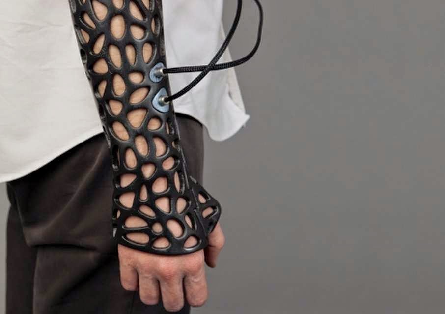 46 Unbelievable Photos That Will Shock You - This 3D-Printed Cast Uses Ultrasound to Heal Bones 40% Faster