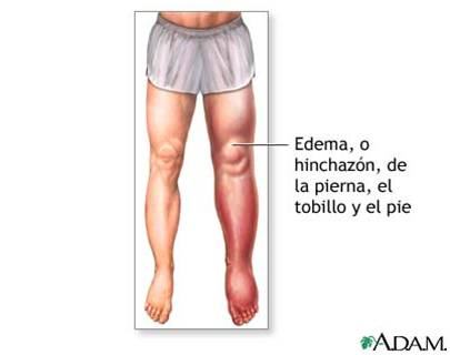 Aja aja fighting ara aliyara: MEDICAL PICTURE