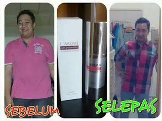 beli larome slimming serum di palangka raya