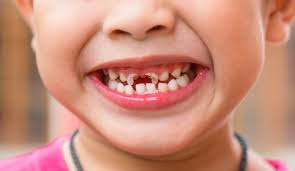 http://www.dental-clinic-delhi.com/dental-tips-for-kids-adults.html