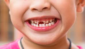 Early Milestone for Your Kid's Teeth