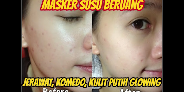 Cara Memutihkan Badan Dengan Susu Beruang Secara Alami