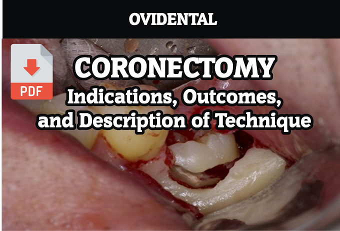 PDF: Coronectomy - Indications, Outcomes, and Description of Technique