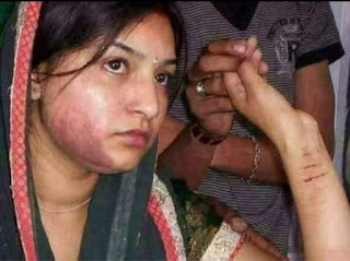 অ্যালার্জির সমস্যা দূর করবেন যেভাবে?/How to eliminate the problem of allergies?