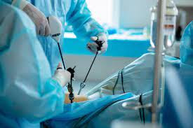 arthroscopy manufacturers