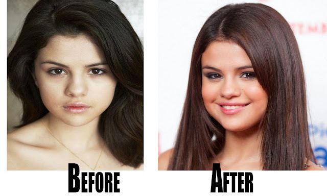 Selena-Gomez-without-makeup
