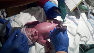 a preemie baby has just been born. She is laying on the table where the doctors are checking her vitals