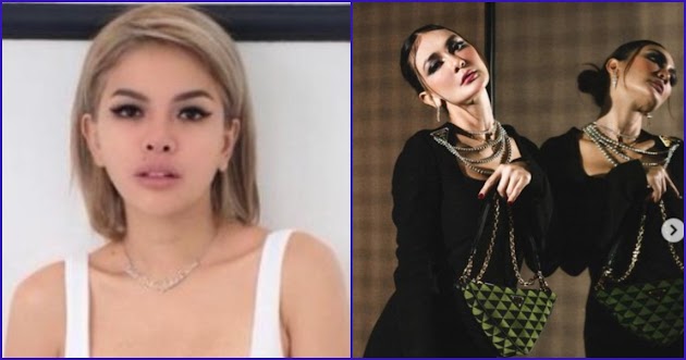 Luna Maya sampai Dibuat Melongo, Demi Penampilan Paripurna Nikita Mirzani Lakukan Operasi Hidung Rp 700 Juta