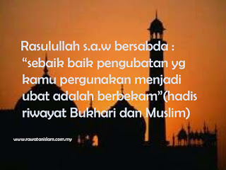 Berbekam adalah amalan Rasulullah s.a.w