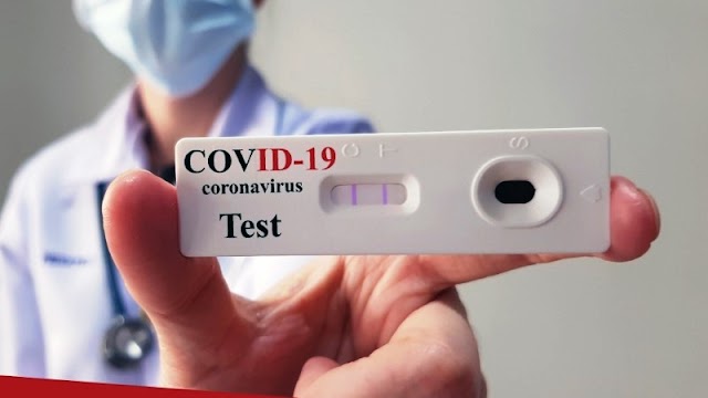 CORONAVÍRUS / Prefeitura de Parnaíba disponibiliza testes rápidos para sintomáticos