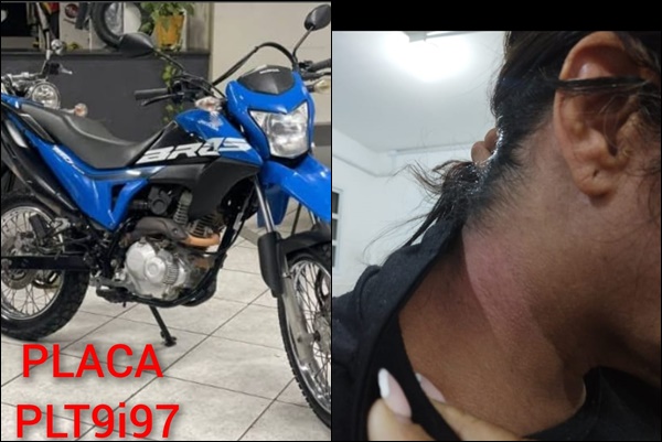 Mulher fica com hematomas no pescoço, após ser agredida com arma durante assalto no centro de Porto Seguro.