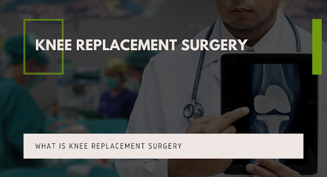 What is Knee Replacement Surgery