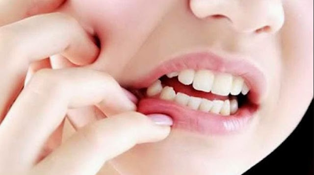 penyebab dan cara mengobati sakit gigi