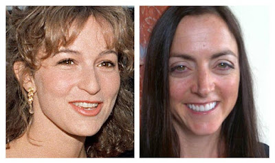 Jennifer Grey Plastic Surgery