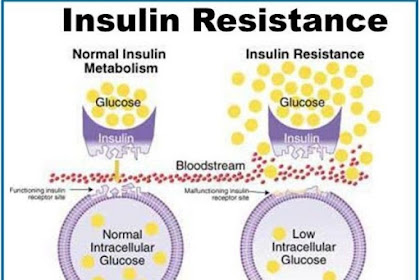 Diet for Insulin Resistance to Lose weight