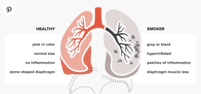 smokers lungs images