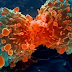 DOES THE KIND OF FOOD WE EAT CONTRIBUTE TO CANCER DEVELOPMENT?