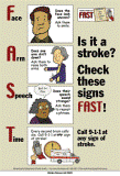 Metode FAST untuk stroke