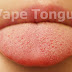 Penyebab dan cara mengatasi vape tongue 