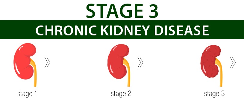 Is stage 3 chronic kidney disease fatal?