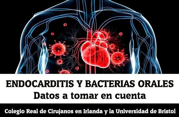 ENDOCARDITIS: Bacterias orales y su relación con este grave problema cardíaco