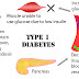 Find understand the mechanisms of type 1 diabetes