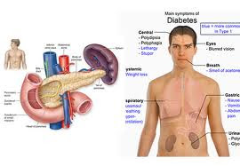 Cara Mengetahui Tanda dan Gejala Penyakit Diabetes Mellitus