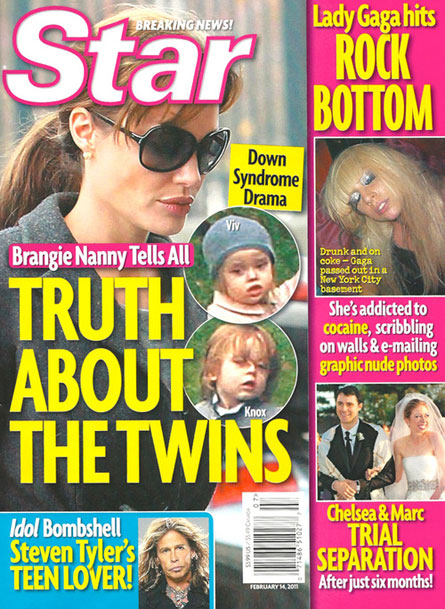 brad pitt and angelina jolie twins have down syndrome. might have Down syndrome.